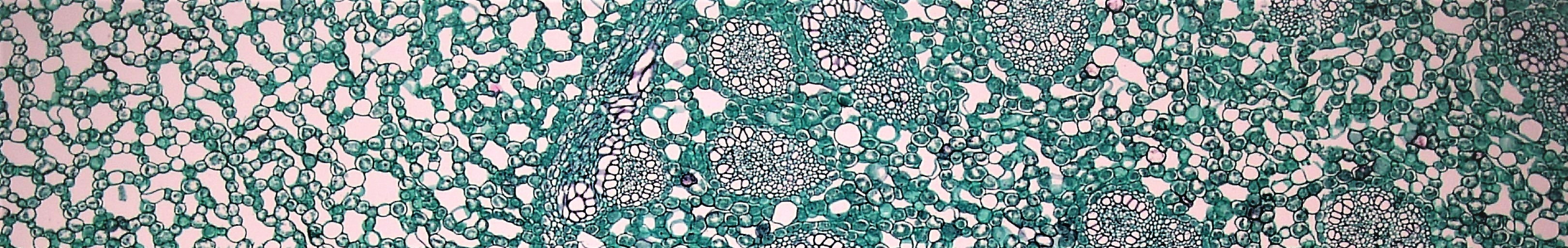 Perennial Monocot Stem: Cortex and Stele in Acorus Rhizome.